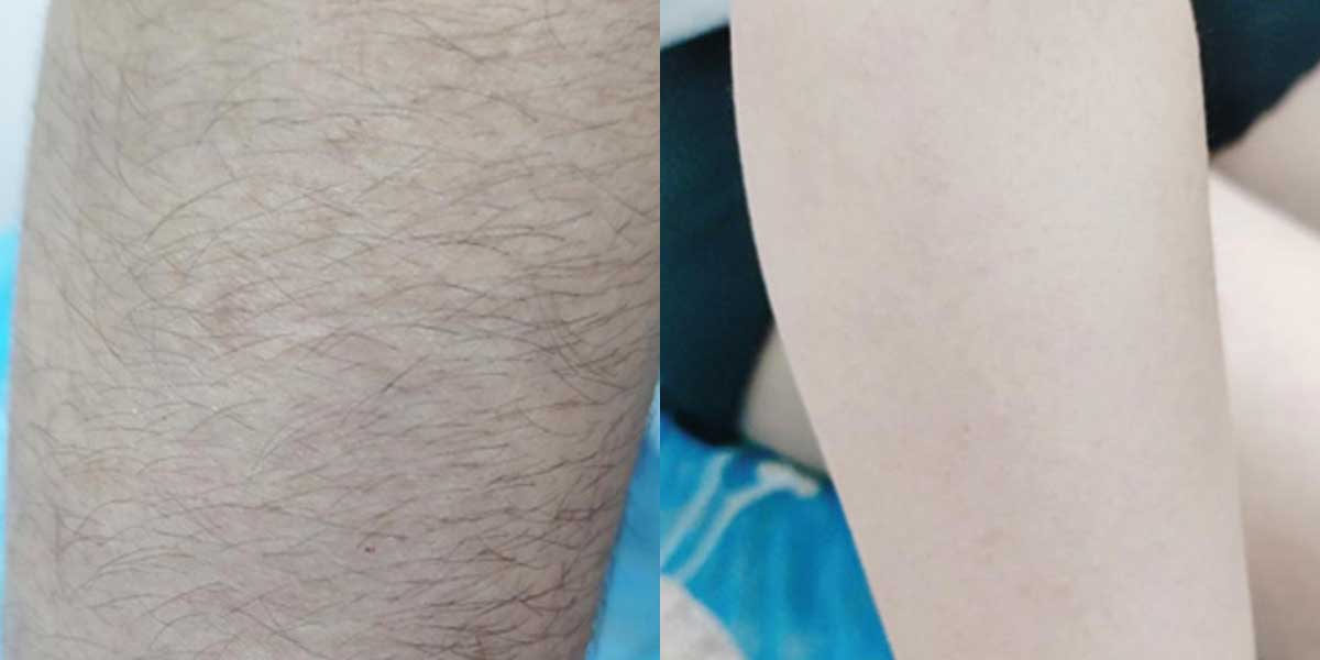 before-after-01