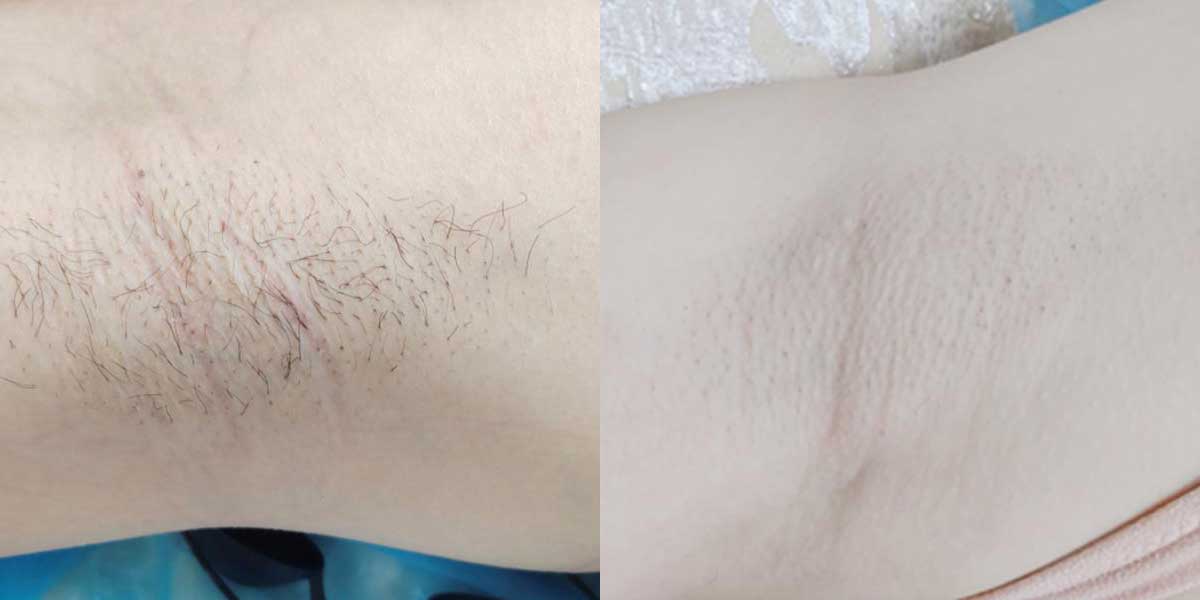 before-after-02